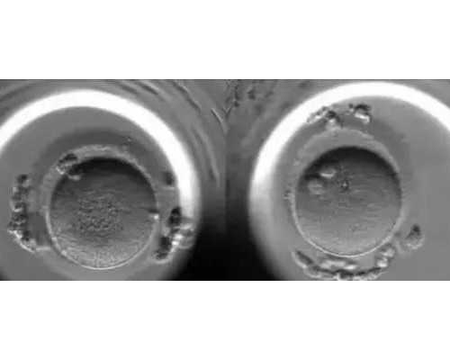 天津供卵试管婴儿费用_婴儿小腿皮肤粗糙怎么回事