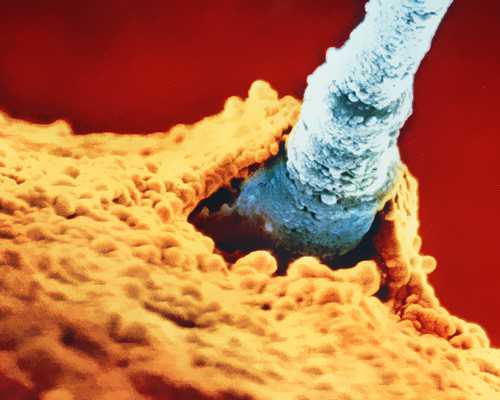 天津借卵子生子又后悔_对于孕期会生长的妊娠纹，该怎么预防呢？