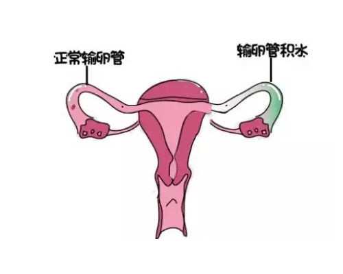 世纪招聘代妈信息_孕妇瑜伽动作拍照技巧