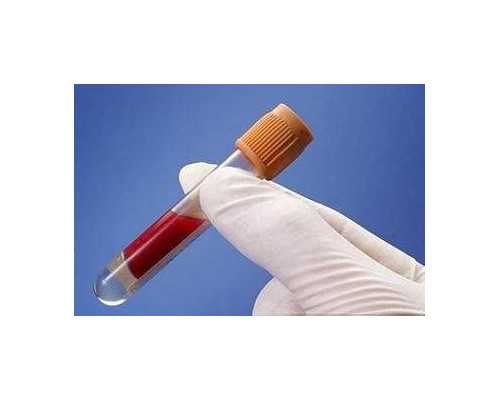 试管代妈费用知乎多少_冬季科学备孕需特别注意四“养”