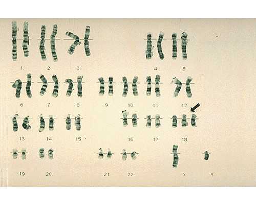 代妈不成功为什么_备孕助“性”的那些食物
