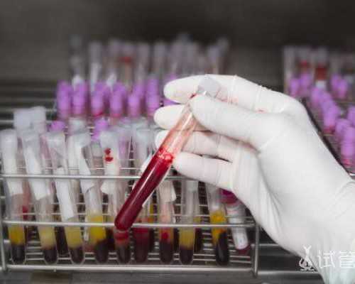 2025万招聘代妈_夺走你好“孕”气的杀手