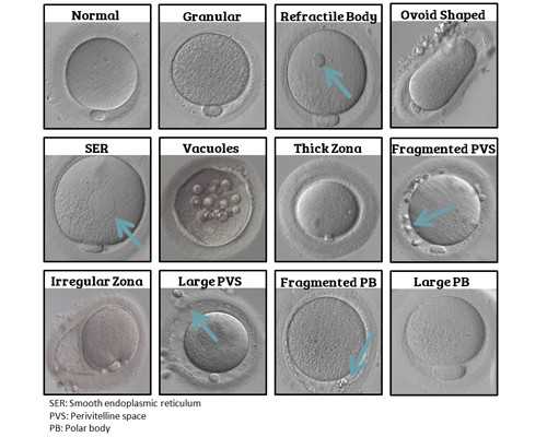 天津借卵试管流程_小产后恶露几天算正常