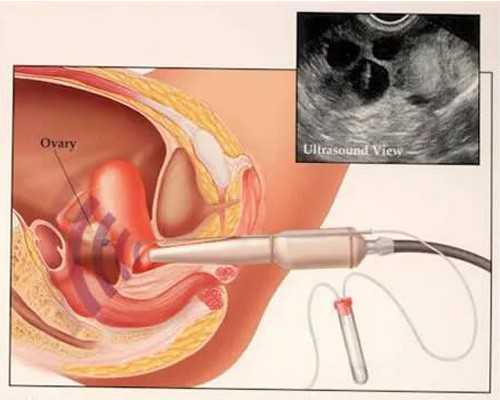 找代孕电话-天津代孕机构有哪些_六个月宝宝能吃蛋清吗