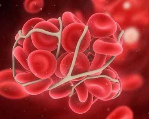 37岁做代妈可以_减轻疼痛助分娩,孕妇操是首选