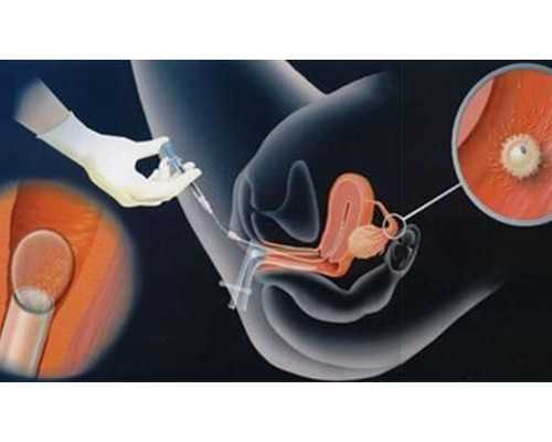 说说我的代妈经历_【孕妇营养餐】营养师分享：长胎不长肉的孕期营养餐单