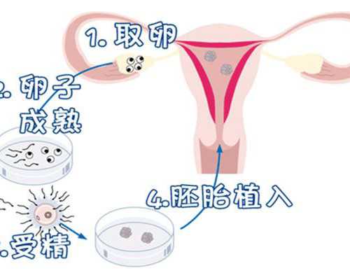 天津借卵生子亲子鉴定_宝宝为什么老打喷嚏