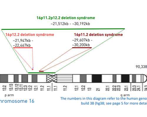 代妈中介询问精因宝贝_宫缩痛的睡不着怎么办