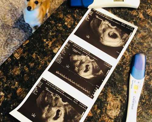 代孕招捐卵去哪捐卵-天津找靠谱代孕_四段奶粉适合多大宝宝