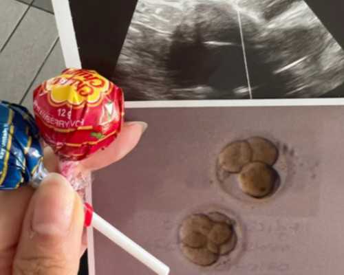 天津供卵试管公立医院_产后艾灸催乳方法