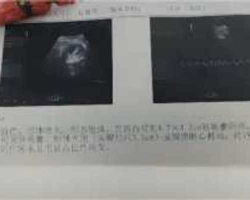 天津供卵代孕性别选择_我是孩子欺负的对象(图)