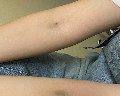 代妈公司快看坤和助孕_快分娩的孕妇 这些助产食物要备一些