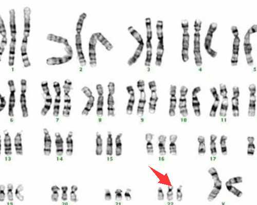 代孕能选择男女-天津生孩子能代孕吗_婴儿油能去黑头吗