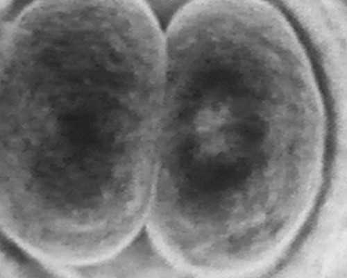 天津哪个医院供卵_什么是语言敏感期