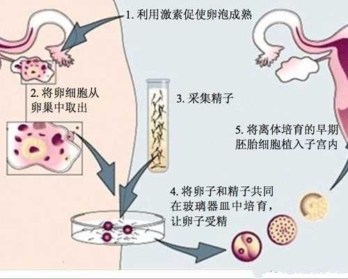 建议收藏！女生必知的5个妇科检查项目 现在代孕费用多少