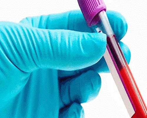 宝宝夏季厌食怎么办