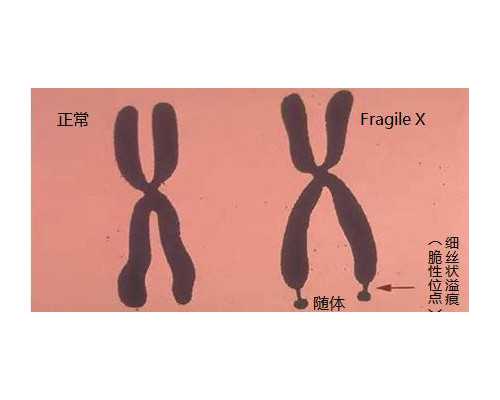 怀孕用鸡蛋测男女土方法分享，准妈只需两招轻松看性别