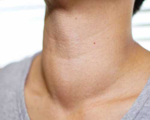 正规代妈就到ymfc放心_自然代妈有感情了吗_泰国试管技术助孕是否真的靠谱?看