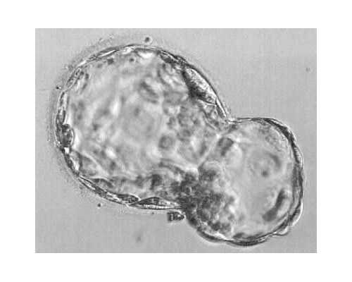 准备做代妈_做试管婴儿助孕要怎么提升卵子质量?