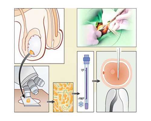 找试管代妈AA69很好_杭州助孕试管婴儿前如何调整子宫内膜