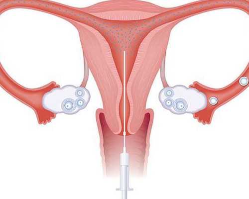 百度分享代妈微信_试管助孕胚胎移植后“有人欢喜有人愁”，区别只在1个关键