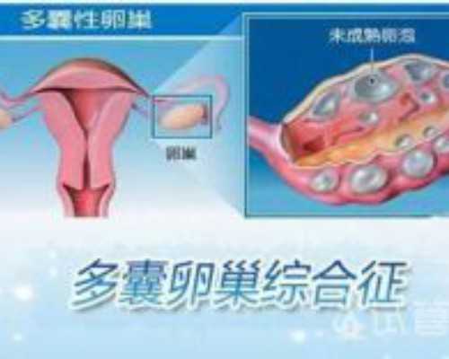 有没有代妈交流群_备孕或辅助生殖助孕可以打新冠疫苗吗？