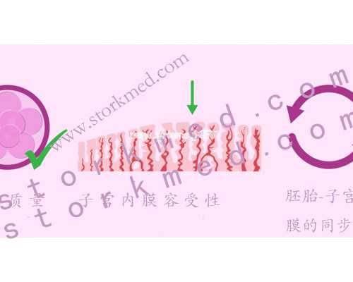 自然代妈吧_找一个自然怀孕代妈_在什么情况下我们需要选择试管婴儿助孕？