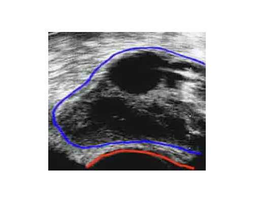 急找重庆代妈 2024重庆市妇幼保健院试管婴儿生男孩费用一览 ‘无创dna报告18看
