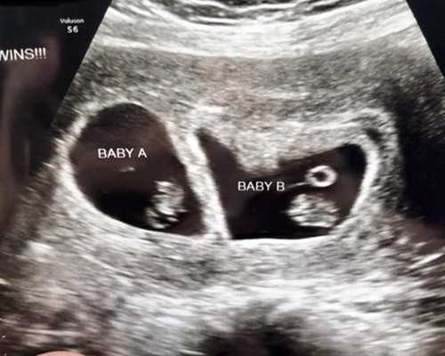 2022陕西失独家庭最新补贴政策，陕西失独再生育申报流程