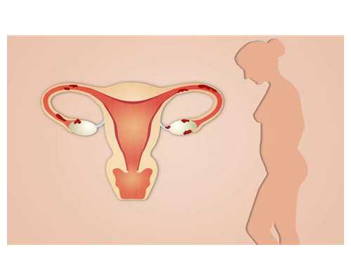 重庆第三代试管的流程与费用怎样的？