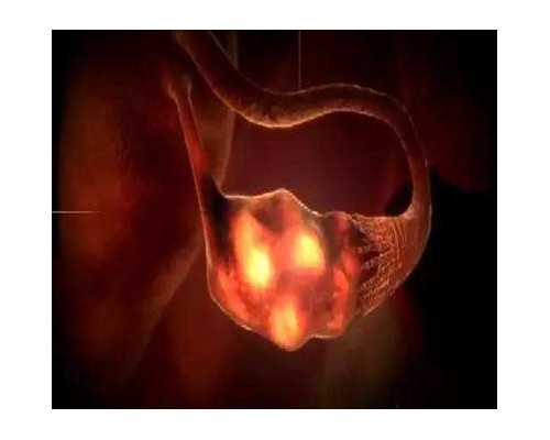 三个月宝宝歪脖子图片怎么纠正