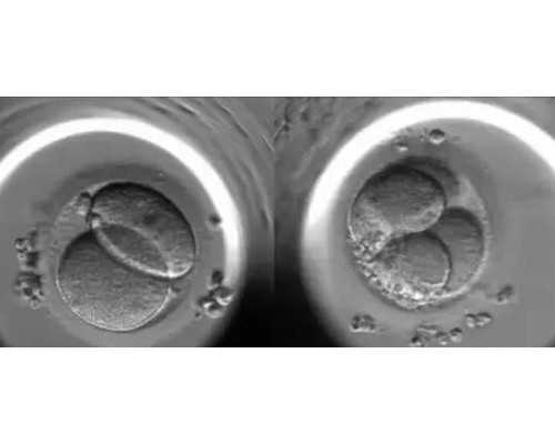 找试管代妈信赖AA69_助孕代妈介绍所_新余市做一次试管婴儿助孕多少钱,市妇幼