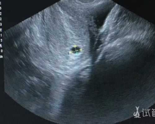 去中介找代孕靠谱吗-天津有供卵试管吗_新妈妈产后第一天必学课程