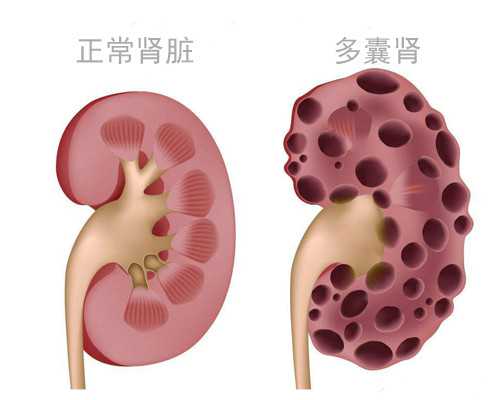 50岁高龄做试管婴儿机会大吗？期间需要注意些什么