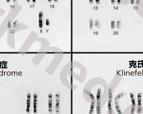 最新代妈贴吧_输卵管性原因不孕做试管婴儿助孕是更好得选择？