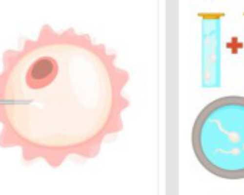 找自然代妈怎样_真心做代妈去世纪_北大医院做试管助孕怎么样？这份费用明细