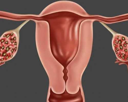 取卵后吃酸菜要想不加重积液，事先须知晓这三大禁忌