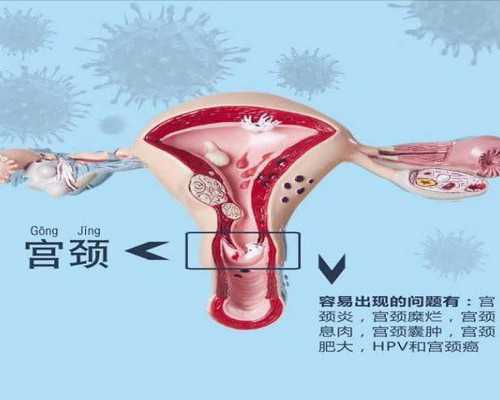 中美泰代妈招聘_助孕瑜伽方法讲解