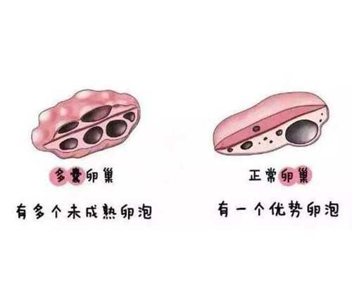 备孕要抓住排卵时机，一个月会有几次机会呢？