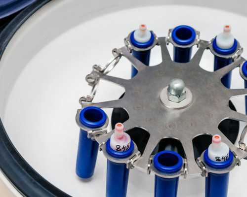 卵巢功能衰退可以通过食疗调理，日常生活中要注意这些