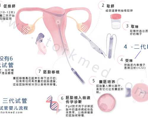 卵子质量怎么检查？检查卵子质量该怎么做？