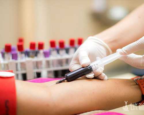 自然受孕代妈公司_试管助孕前有哪些指标可以评估生育力？