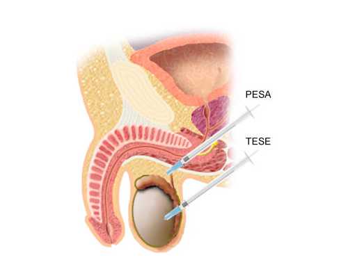 染色体异常千万别自怀！遗传下一代真不是说说而已
