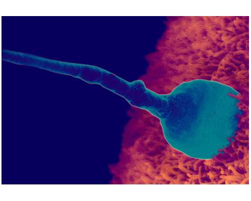 自然受孕代妈经历_知名代怀孕高薪招聘代妈_十月梦美大事记 美国试管萌娃播报