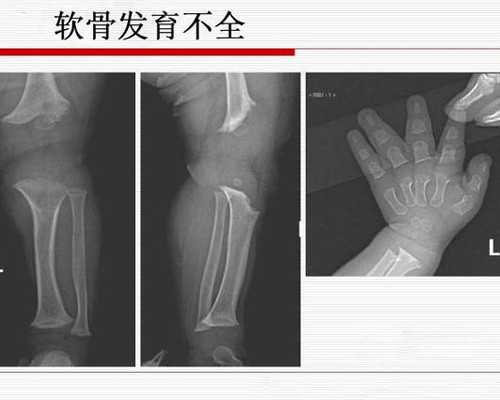 中介介绍代妈_自然代妈的感受_一起见证昆明助孕试管婴儿从促排卵到胚胎移植