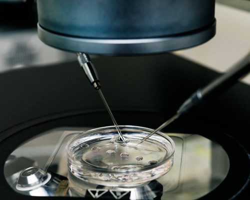 最新代妈贴吧_海外助孕试管婴儿取卵费用是多少