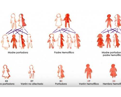 我十八岁，有乳头内陷，不是很严重，有方法可以矫正？不想手术，听说有乳头