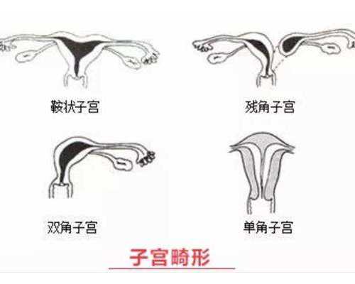 找人工授精代妈服务_孕酮低怎么办？吃点什么能助孕？