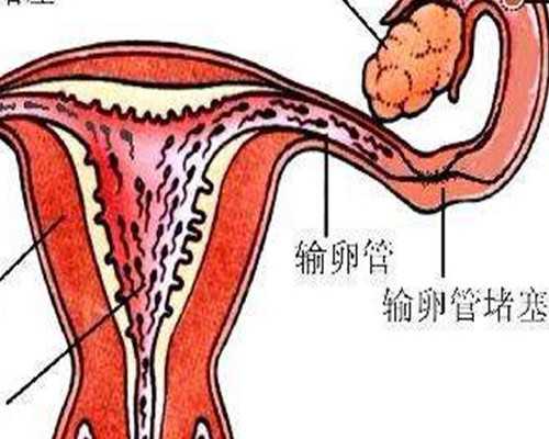 疫情下的代妈：动态分级防控关注特殊人群求助