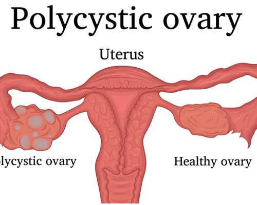 江苏无锡四院试管婴儿费用要多少？2022年无锡四院试管婴儿费用一览
